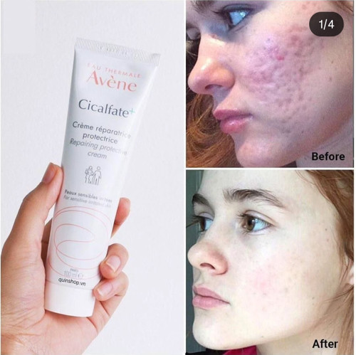 اون پلاس کرم ترمیم کننده ✅️