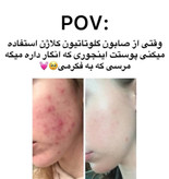 صابون گلوتاتیون اصل – روشنکننده و نرمکننده پوست