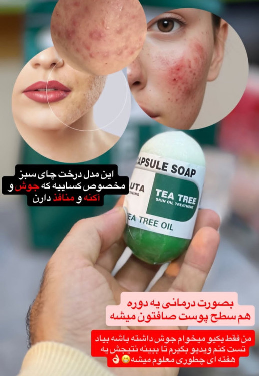 چای سبز مناسب پوست چرب و جوشدار