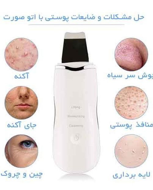 پک کامل پاکسازی پوست ۴کاره | میکرودرم، ماساژور واتو صورت بخور سرد اورجینال