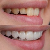 Orginal خمیردندان سفیدکننده مارویس مدل Whitening Mint حجم ۸۵ میلیلیتر