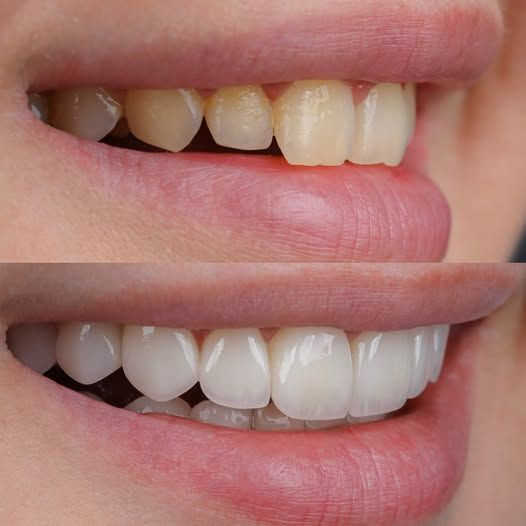 Orginal خمیردندان سفیدکننده مارویس مدل Whitening Mint حجم ۸۵ میلیلیتر